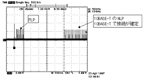 波形5 Switching HUBと10BASE-T専用機との接続時 (FLPを送信後、10BASE-T(NLP)で接続が確定している)